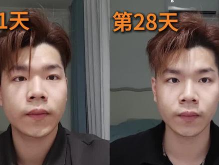 最强瘦脸操跟练版!第29天 #自律 #瘦脸 #瘦脸操 #跟练 #自我成长