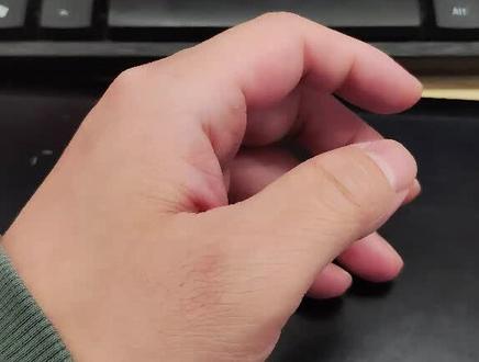 我好像严重了,记录一次双相情感障碍抑郁期的躯体化反应