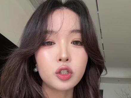 植发第607天跟大家说说心里话#植发攻略 #植发 #植发的人后来怎样了 #植发际线后一年真实案例 #变美