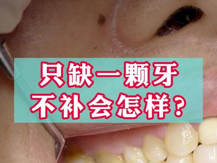 只缺一颗牙,不补会怎么样#口腔健康 #口腔科普 #牙齿健康 #小荷门诊爱牙