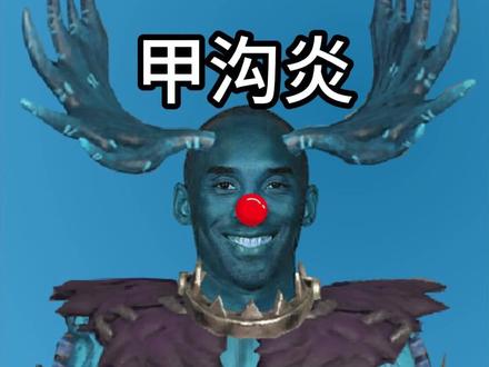 鹿头:孩子们我有甲沟炎 #第五人格 #玩的就是第五人格