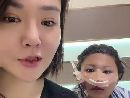 兔唇鼻修复 女孩子一定要爱自己 @扎囊 #正畸的心路历程 #正畸的心路历程