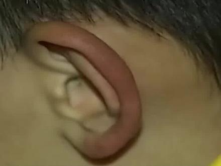 湖南11岁男孩天生顺风耳,听力超群异于常人,专家都被惊到了