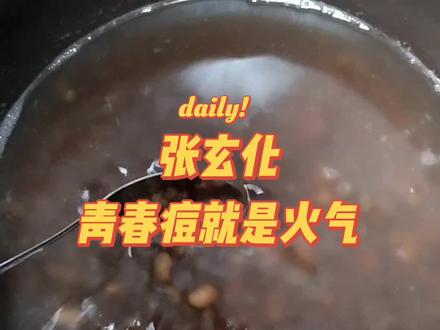 不是每个青春期的孩子都要长痘的,完全跟你的饮食生活习惯有关系 #古中医养生 #中医养生 #中医养生调理 #青春痘 #豆豆饮