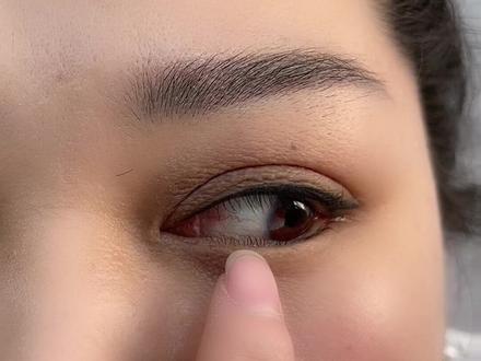 下睫毛倒睫 颧骨高 肉厚,眼贴胶带准备工作做的是否到位,直接决定嫁接效率 嫁接速度 #睫毛 #美睫 #美睫培训