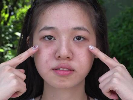 普女微调40%的变化有多大 #变美 #微调 #轮廓