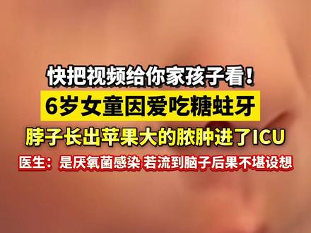 快把视频给你家#孩子 看!6岁女童因爱吃糖#蛀牙,脖子长出苹果大的脓肿进了ICU,医生:是厌氧菌感染,若流到脑子后果不堪设想