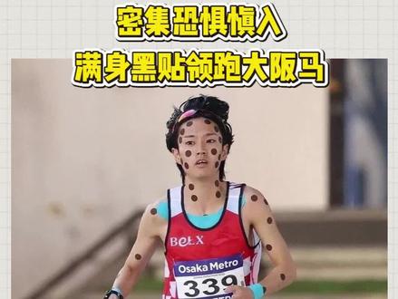密集恐惧慎入!大阪马23岁小将贴满黑贴狂飙,结局太意外