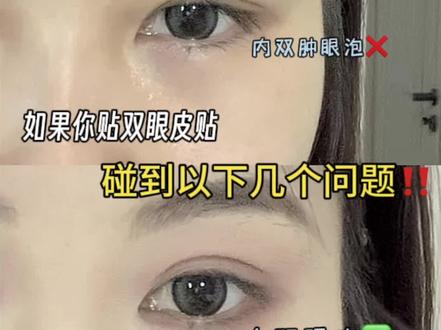 内双肿眼泡,贴双眼皮贴总是碰到以下几个问题,手把手教你精准解决!#双眼皮 #肿眼泡 #眼妆
