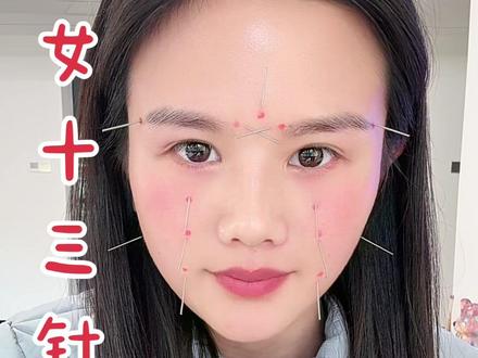 坚持✊相信我们老祖宗的智慧 #玉女十三针 #变美逆袭 #护肤 #面色红润有光泽 #针灸调理