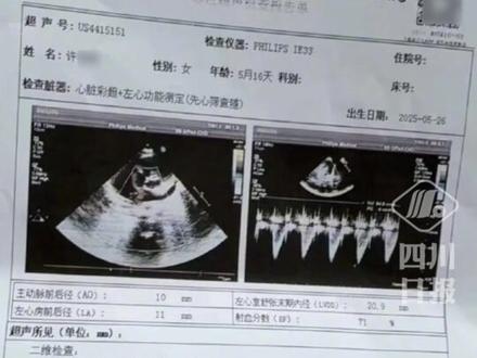 5月龄女婴心脏手术期间离世,宁波市卫健委:成立调查组