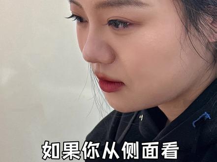 鼻基底训练❗️每天3分钟面中立体不干瘪
#上热门抖音小助手 #抖音创作者中心 #创作者中心创作 #面部瑜伽 #鼻基底凹陷