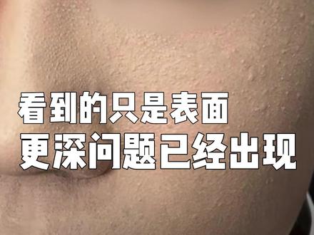 上完粉底皮肤特别粗糙怎么办——手把手教学妆感提升