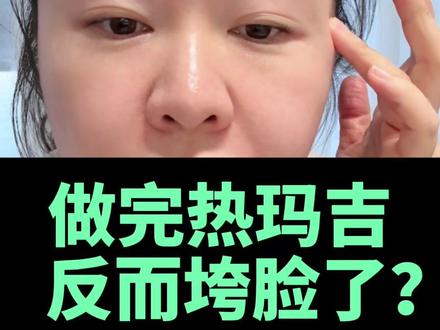⚠️不是所有人都能做光电!这2种人做完必垮脸 #热玛吉 #超声炮 #光电项目 #垮脸 #面部提升