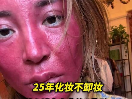 25年化妆不卸妆!美女博主变“关公脸”。当事人:脸部红肿不敢见人!#化妆 #不卸妆的危害