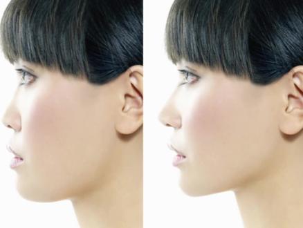 侧脸液化 能够征服无数美少女的液化技巧!#人像精修 #修图前vs修图后 #后期修图 #液化 #侧脸修图