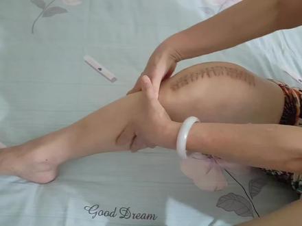 膝关节置换术后一个月有感