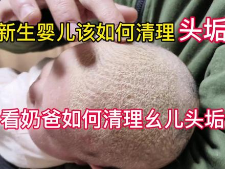 新手爸妈如何给新生婴儿清理头垢! #头垢如何清理 #头垢清理 #奶爸带娃