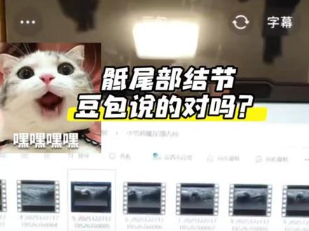 骶尾部结节的小男孩,拒绝核磁,我只能求助豆包了,它说的对不对?#谁能看出这有什么门道 #豆包 #超声影像 #AI辅助诊断 #病例分享