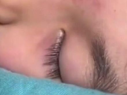 6岁女儿看电子产品过敏起疹 妈妈称挺好的(先锋新闻)