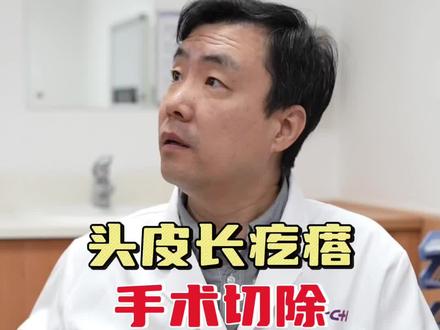 头上长疙瘩硌得慌#医者仁心 #神经外科郭毅 #医生日常 #手术 #皮脂腺囊肿