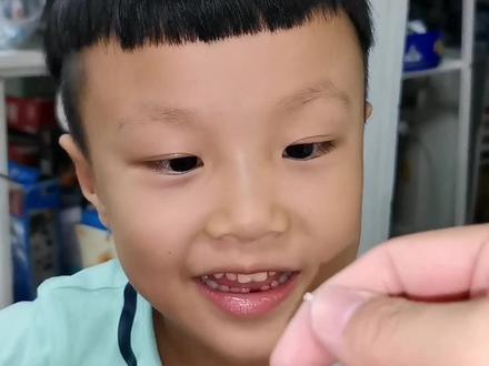 #宝贝换牙 #牙齿系绳方法。猪鼻扣系绳拔牙。后附系绳方法。
