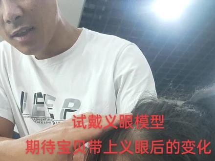 #记录真实生活 #勇敢的宝宝 #义眼女孩 医生说小眼球下眼皮有些外翻,上睫毛扎到下眼皮的内敛导致内敛发红,发痒有炎症,带上眼片撑起来就好多了,期待改变