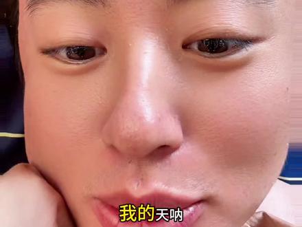 我的天 1.24 #狗总