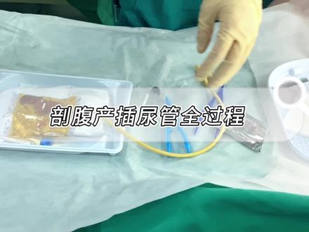 听说插进去能接受,拔出来特酸爽….你们插尿管是麻醉前还是麻醉后?🤔#剖腹产 #插尿管