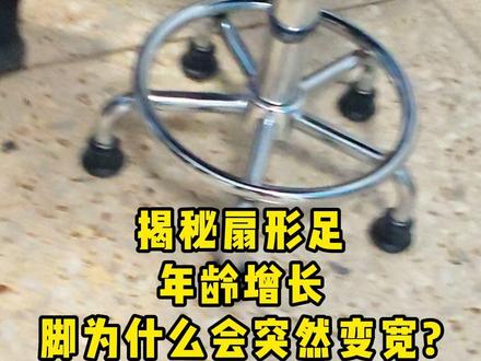 揭秘扇形足,年龄增长,脚为什么会突然变宽? #拇外翻 #拇外翻矫正 #扇形足