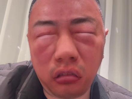 你卖的那个不是春芽,是漆树芽芽#春芽 #这是真人吧#你肿么了