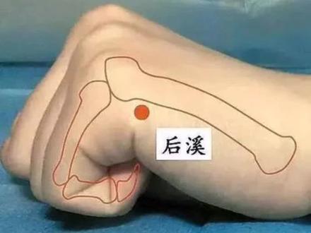 第一次下后溪穴,进针过程十分艰难😂#倪海厦老师讲中医 #全民一起学中医