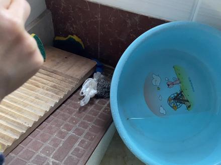 头发弄到手指拇里面去了怎么办?用尽各种方法都没弄出来!