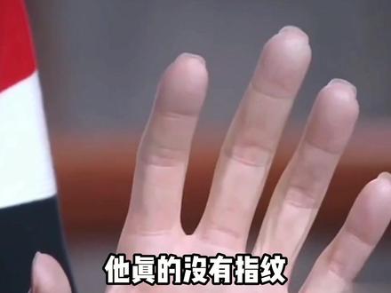 游泳运动员没有指纹,运动员的成功背后都是付出了常人十倍二十倍的努力,向他们致敬#奥运会#中国游泳队#孙杨