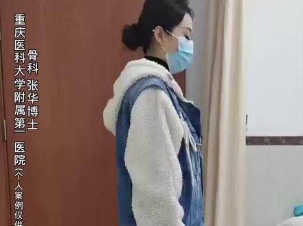 突然大量运动后,竟会出现这样的情况 #医生的日常 #医学科普 #运动#膝关节 #减肥 @DOU+小助手