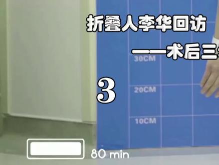 被敲断大腿、脖子、脊椎,再换掉髋关节,四次“粉身碎骨”后,他终于可以抬起头了#纪录片 #真实事件 #励志 #泪目 #感动 @抖音小助手