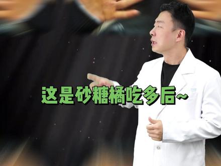 能改变肤色的食物 #王洋狂想记 #沙糖桔 #猎奇