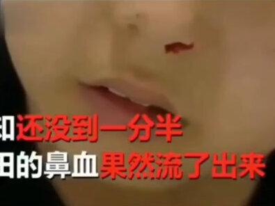 男孩患上罕见“厌学症”:一学习脑袋就疼,写作业就流鼻血!