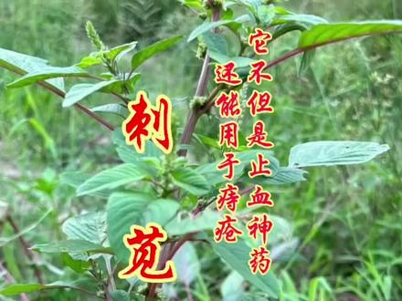 路边这株带刺的草,不但是止血神药,典籍收录能治痢疾痔疮! #中医养生 #痔疮 #痢疾 #湿疹 #刺苋 路边这株带刺的“野苋菜”,老辈们说它赛过人参,它看似是入侵杂草,实则是古籍里的止血解毒良药,但它还有严格禁忌,它就是刺苋
《岭南采药录》记载:“取叶茎煎饮,清热解毒,散血消肿,治痢;煎水洗痔疮,消水肿;又捣烂以之擦血癣。”《福建民间草药》记:“消痈散结,杀虫解毒。”《中华本草》明确:“凉血止血,清利湿热,解毒消痈。用于痢疾,肠炎,胃、十二指肠溃疡出血,痔疮便血;外用治毒蛇咬伤,皮肤湿疹,疖肿脓疡。”
关键警示:《广西中药志》提示“虚痢日久及孕妇忌服”;过量服用可能出现眩晕、呕吐等不适,切勿自行盲目使用。