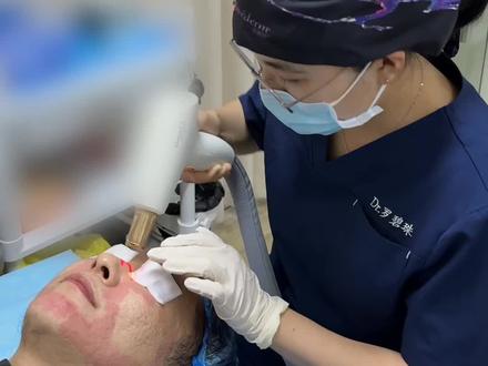 点阵Up镭射并不是适合所有人,不要盲目迷信进口设备!#痘坑联合治疗 #痘坑修复 #痘坑毛孔粗大 #痘坑填充 #广州罗碧珠