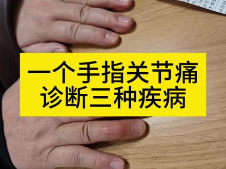 #关节疼痛不简单 #关节炎病因#关节痛病因 #手指关节痛原因 #手指痛原因
