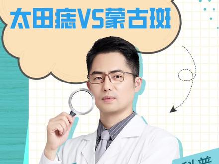 身上的大片青蓝是什么呢?#太田痣 #蒙古斑 #痣