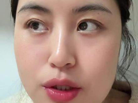 长护险虽然好但也不是只要年纪大了就能领它有一套严格的入门考试
如果你要跟老百姓讲清楚可以参考下面这个三步走的拆解
第一步看硬杠杠申请资格
想申请上海长护险要先过这三关
第一年龄关必须年满60周岁
第二医保关参加了上海市职工医保且已办好退休领养老金手续或者居民医保
第三户籍居住关主要是针对上海参保人员
第二步核心入门证评估等级
上海长护险不是按年龄发钱而是按失能程度给服务申请后会有专业的评估员上门给老人的生活能力打分
等级划分一共有1到6级1级最轻6级最重
门槛线2级含以上才能享受长护险待遇
1级属于轻度失能目前暂时不享受长护险的上门护理
2到6级级别越高说明失能越严重国家给的补贴和上门服务的次数就越多
第三步能拿到多少好处补贴与频次
这部分是老百姓最关心的账本子
第一居家上门服务最常见
如果老人住在家里由护理员上门
2到3级每周上门3次
4级每周上门5次
5到6级每周上门7次基本天天都有人来帮衬
费用目前上海的标准大约是65元每小时但长护险基金帮你报销90%个人只需要出10%也就6块5左右就能请到一个专业的护理员上门忙活一小时
第二养老机构护理
如果老人住在养老院
长护险会根据等级直接补贴给机构抵扣一部分护理费等级越高抵扣越多比如5到6级每天能抵扣30元左右一个月能省下大几百甚至上千
小亚式避坑提醒
大家注意啊这个评估等级不是一劳永逸的评估结论有效期通常只有2年快到期前2个月记得一定要去社区窗口申请期末考续评不然待遇就断了
另外申请评估是要交钱的每次200元不过长护险基金会帮你出大头80%你自己只要付40块钱就行#上海长护险 #长护险申请流程 #长护险申请条件 #长护险政策