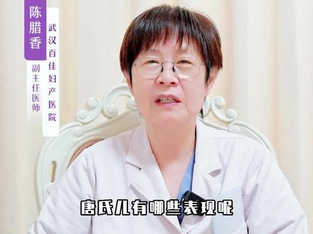 唐氏综合症的典型特征#健康守护计划 #唐氏综合征 #武汉百佳妇产