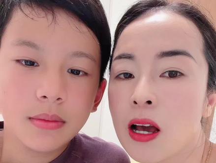 从小给孩子容貌干预,真的可以提升孩子的颜值,视觉先行的时代,孩子颜值也需要从小托举的#牙齿矫正后的改变 #颜值