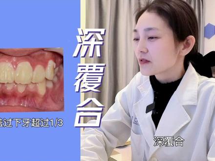 牙齿问题多,没有关系,因为我会出手#深覆合 #深覆合牙齿 #武汉牙齿矫正