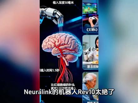 马斯克脑机接口又炸场!开颅插针1.5秒极限操作,这黑科技直接把科幻变现实! #知识科普 #人工智能 #科技创新 #芯片 #新科技
