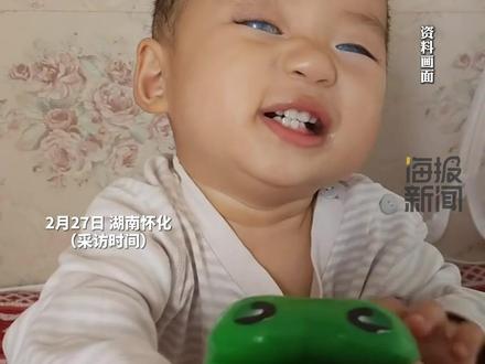 1岁半孩子患先天性青光眼没有虹膜,孩子妈妈:“目前病情恶化,正准备进行第三次手术”#热点新闻事件 #热点追踪 #青光眼 #坚强的孩子 #勇敢的宝宝