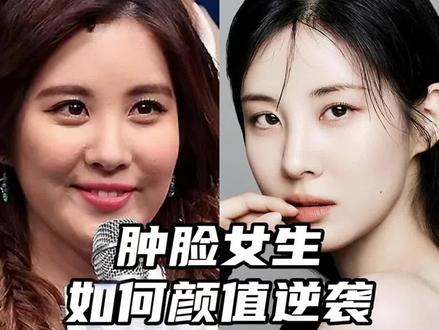 肿脸女生如何颜值逆袭#美商实验室 #整商 #徐贤 #少女时代 #颜值