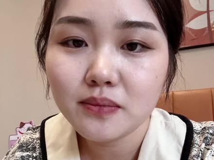 刀口沟通很有必要姐妹们,不要觉得不好意思,是横切竖切,用不用美容线,甚至长度,腹直肌缝合,咱都可以在生前一天入院待产时,咨询自己的主管医生#剖腹产 #剖腹产刀口 #产后宝妈 #坐月子